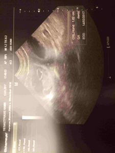 Wurfankündigung vom Wildenburger Land 